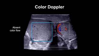 Part 3 Neuro Urology in Daily Practice  Urodynamics [upl. by Dorene]