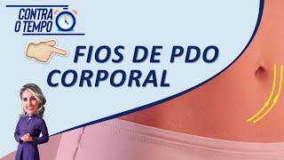 Fios de PDO para tratamento Corporal  Dra Fernanda Sulzbach e Dra Cinara Turra [upl. by Ecertal]