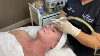 Microdermabrasion Facial Demonstration [upl. by Zak]