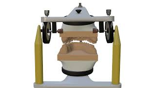 Occlusion Articulator parameters [upl. by Isolda]