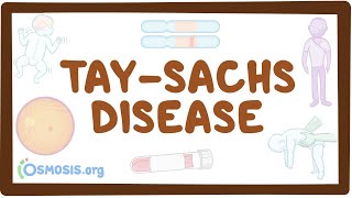 TaySachs disease  causes symptoms diagnosis treatment pathology [upl. by Riesman695]