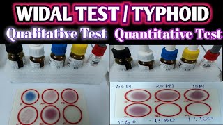 Widal Test Practical  Qualitative Widal Test  Quantitative Widal Test  Typhoid Test [upl. by Onida]