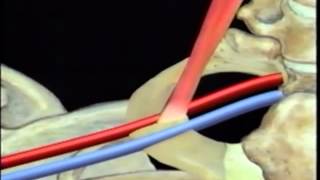 Central Venous Catheter Insertion Demonstration [upl. by Acino]