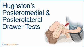 External Rotation Recurvatum Test [upl. by Staffan]