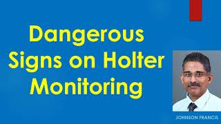 Dangerous Signs on Holter Monitoring [upl. by Nomyar]