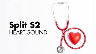 Fixed Split S2  Heart Sounds  MEDZCOOL [upl. by Colville]