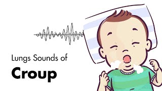 Sounds of Croup Laryngotracheitis  Lung Sounds  MEDZCOOL [upl. by Nilorac20]