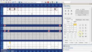 Recording a Perio Pocket Greater than 9 on Dentrix [upl. by Aida]