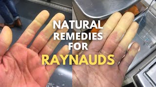 5 natural remedies for RAYNAUDS [upl. by Asoramla254]