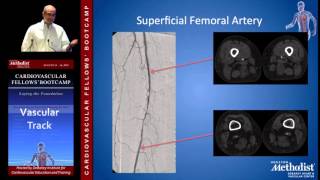 Lower Extremity Anatomy Charudatta Bavare MD [upl. by Esilahc]