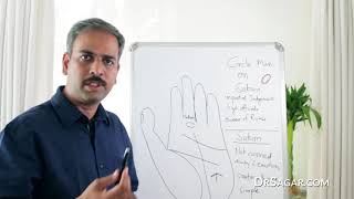 CIRCLE Mark in Hand  Palmistry amp Palm Reading [upl. by Kreda]