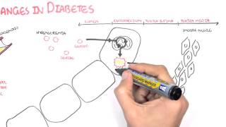 Diabetes Complication and Pathophysiology of the complication [upl. by Annohsal]