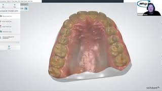 Webinar 3Shape Aligner Studio with Ortho Analyzer with Matthew Davis [upl. by Fleece946]