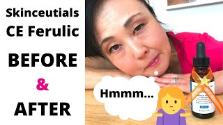 SkinceuticalsCE Ferulic Worth it Before and After [upl. by Iew]