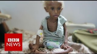 Yemen On the brink of starvation  BBC News [upl. by Dolhenty]