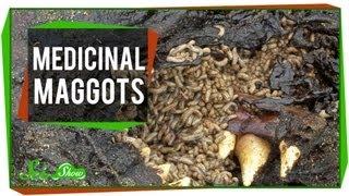 Marvelous Medicinal Maggots [upl. by Martainn]