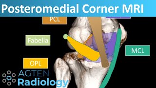 Posteromedial Corner Anatomy on Knee MRI [upl. by Polik]