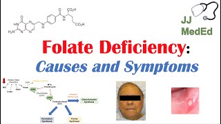 Folate Deficiency Causes ex medications Pathogenesis Symptoms Diagnosis and Treatment [upl. by Eitisahc]